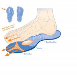 Promed Hallux Valgus Sohle Gre