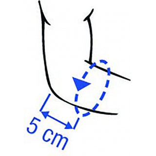 Thuasne EPI-GO Ellbogenbandage